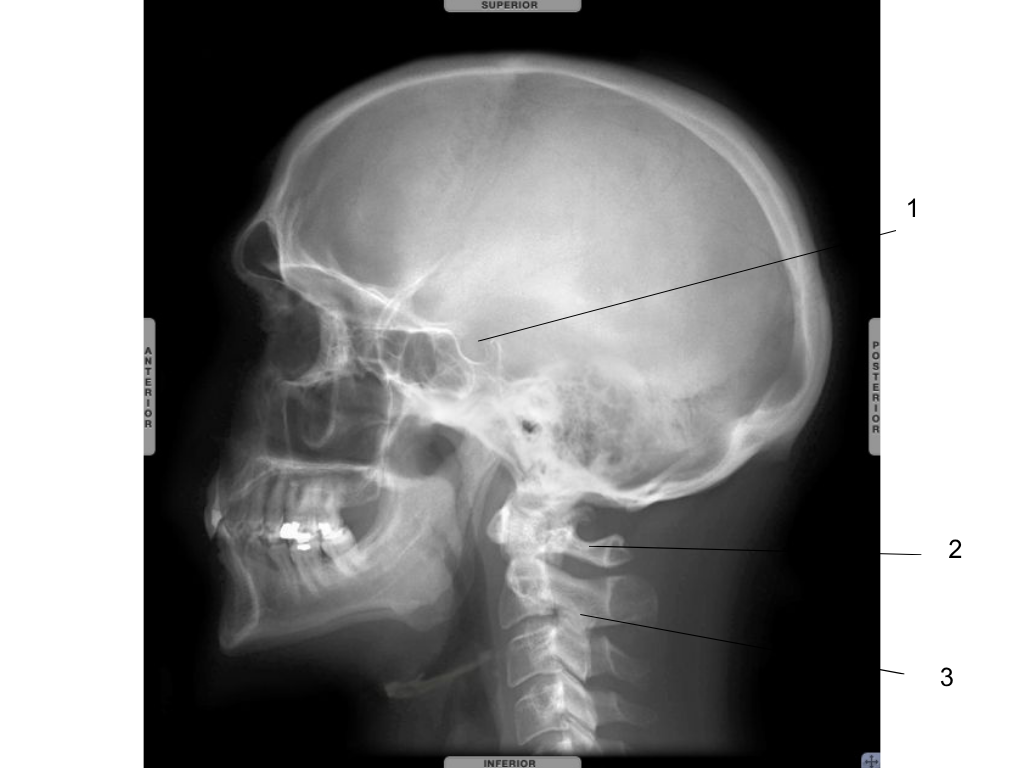 <p>what is #2 pointing at?</p>