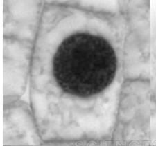 <p>what is this plant cell going through </p>