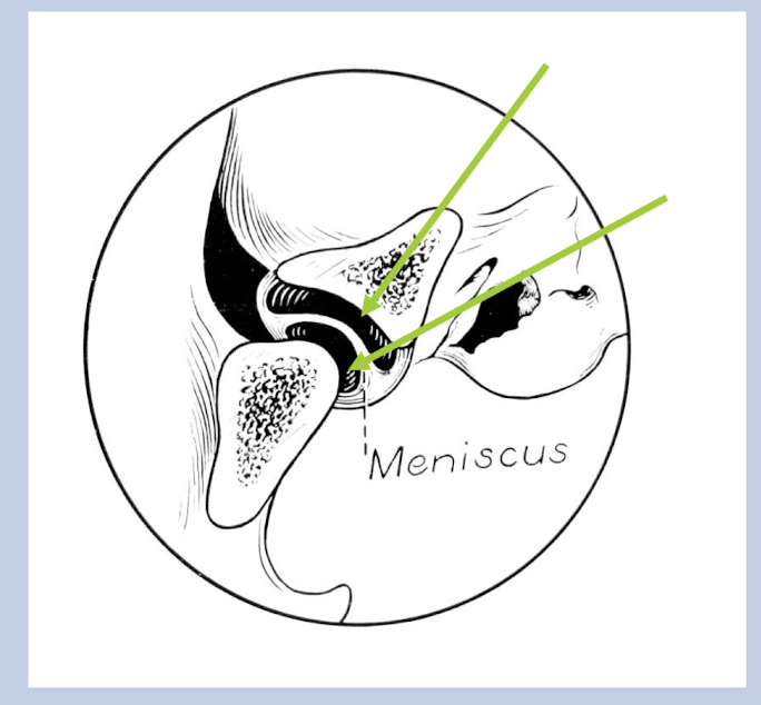 <p>Are divided into meniscotemporal (upper) and meniscomandibular (lower) compartment by fibrocartilaginous articular disc </p>