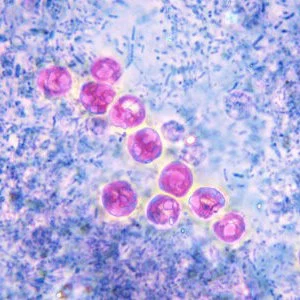 <p>Acid-fast staining they appear pink and 4-5 um, contains 4 sporozoites. DFA, EIA, PCR</p>