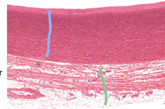 <p>What is indicated by the lines?</p>