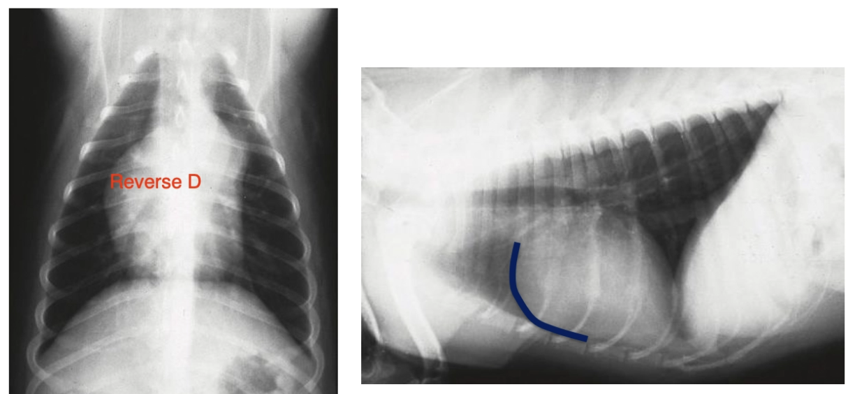 <p><u>History:</u></p><ol><li><p>Usually asymptomatic</p></li><li><p>Exercise intolerance and syncope</p></li><li><p>RCHF</p></li></ol><p><u>PE:</u></p><ol><li><p>Left basilar crescendo-decrescendo systolic murmur and precordial thrill</p></li><li><p>Jugular pulse</p></li><li><p>Arrhythmia and sudden death</p></li><li><p>Ascites and hepatomegaly</p></li></ol><p><u>Diagnosis:</u></p><ol><li><p>Radiograph = RVE, pulmonary artery bulge, hypoperfusion of lungs</p></li><li><p>ECG = Exercise-precipitated ventricular arrhythmia and R-sided cardiomegaly</p></li><li><p>Echocardiography = Confirm diagnosis and determine severity of lesion</p></li></ol><p></p>