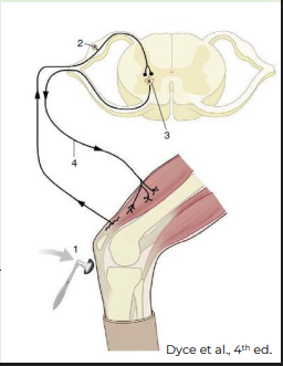 <p>Examples of spinal reflexes, involving spinal nerves and the spinal cord, include:</p><p></p><p><strong>Myotatic reflex (muscle stretch</strong>): muscle stretch is resisted by reflex contraction of the muscle</p><p></p><p><strong>Withdrawal (flexor) reflex</strong>: limb flexes to withdraw from a noxious stimulus</p><p></p><p><strong>Panniculus (cutaneous trunci) reflex:</strong> pricking skin triggers contraction of cutaneous trunci (panniculus) m.</p><p></p><p><strong>Perineal (anal constriction) reflex</strong>: mild compression of the skin of the perineum or anus with forceps causes contraction of anal sphincter and flexion of the tail</p><p></p><p><strong>Myotatic reflex </strong>(muscle stretch): muscle stretch is resisted by reflex contraction of the muscle</p><p></p><p><strong>Patellar reflex</strong>- the most reliable pelvic limb reflex</p><p></p><p>Stretch stimulus on the tendon (1) travels via the <strong>afferent neuron</strong> (2) to the spinal cord</p><p></p><p>Impulse is then transmitted to the <strong>efferent neuron</strong> (3), which stimulates the quadriceps muscle (4)</p><p></p><p><u>Myotatic reflex (muscle stretch)- Patellar reflex</u></p><p>Motor component of this reflex arises from L4-L6 in the spinal cord, which is the origin of the<strong> femoral nerve</strong></p><p></p><p>The femoral nerve innervates the quadriceps muscle- effector muscle of this reflex</p><p></p><p>Simultaneously, it also causes reciprocal inhibition</p><p></p><p>Therefore, this reflex evaluates the integrity of the spinal cord segments (<strong>L4–L6</strong> and sensory/afferent and motor/efferent) as well as <strong>the femoral nerve</strong></p>