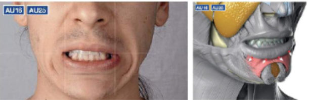<ul><li><p>depresses lower lip </p></li><li><p>pulls laterally</p></li></ul><p></p>