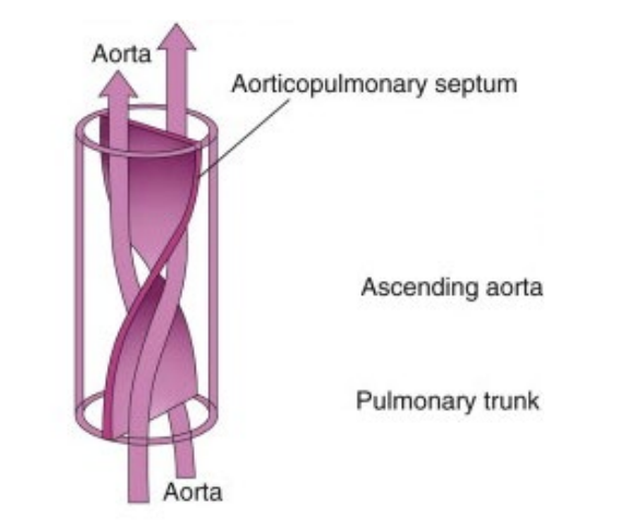 <p>Spiral form of the aorticopulmonary septum</p>