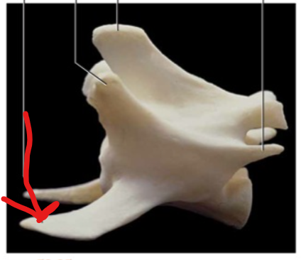 <p>Processes evident on all but the last two lumbar vertebrae that attach ligaments and muscles to stabilize the lower back against rotation.</p>