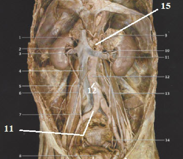 <p>Label 11, 12, 15.</p>