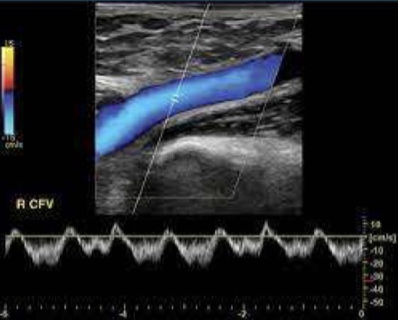 <p>Vascular angiography</p><p>Computed tomography angiography</p><p>Magnetic resonance angiography</p>