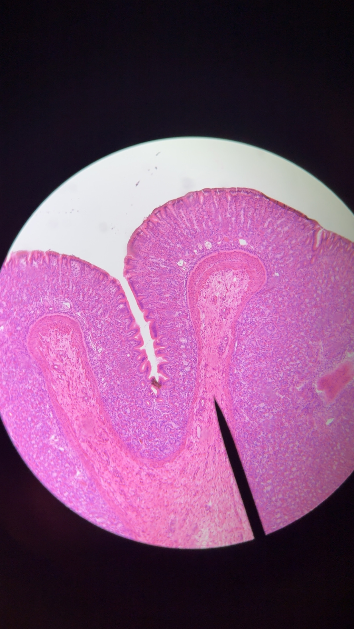 <p>fundic stomach- anatomy &amp; 2 cells </p>