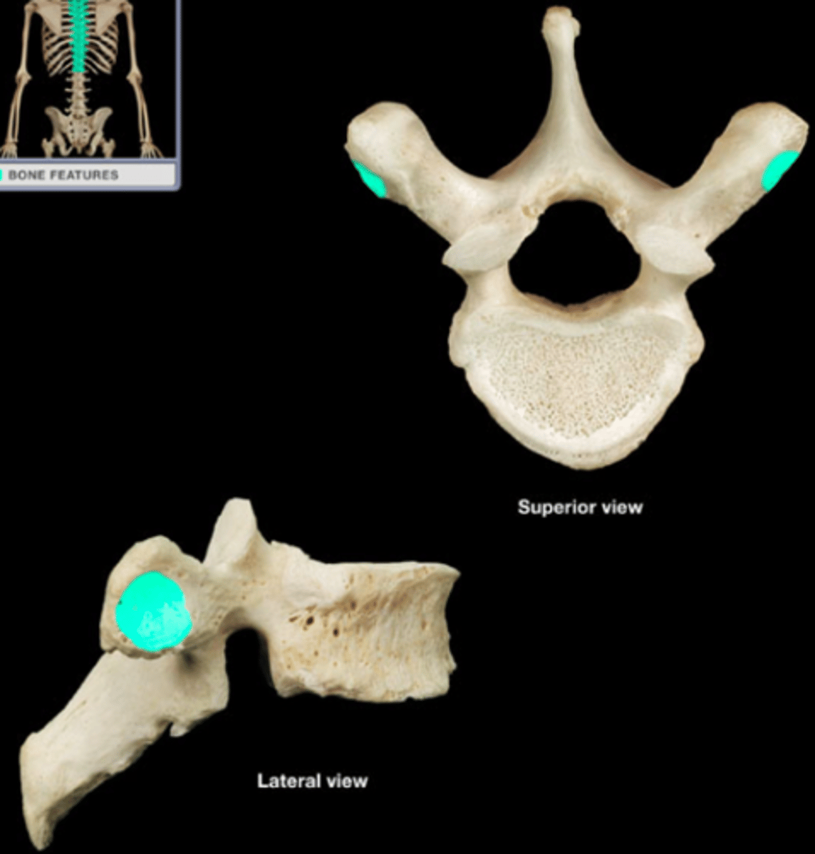 <p>Rib tubercle attachment, sides</p>