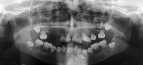 <p>what is the diagnosis?</p>