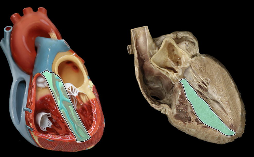 <p>Identify the feature of the right ventricle</p>