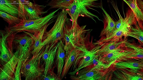 <ul><li><p>wavelength; different wavelength</p></li><li><p>autofluorescence </p></li><li><p>dyes; stain</p></li><li><p>fluorescently-tagged</p></li></ul><p></p>
