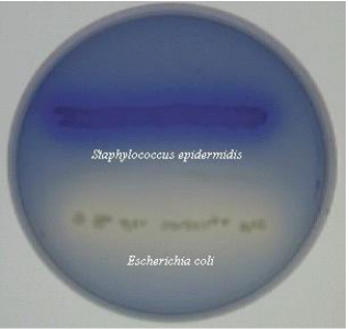 <p>lipid hydrolysis</p>