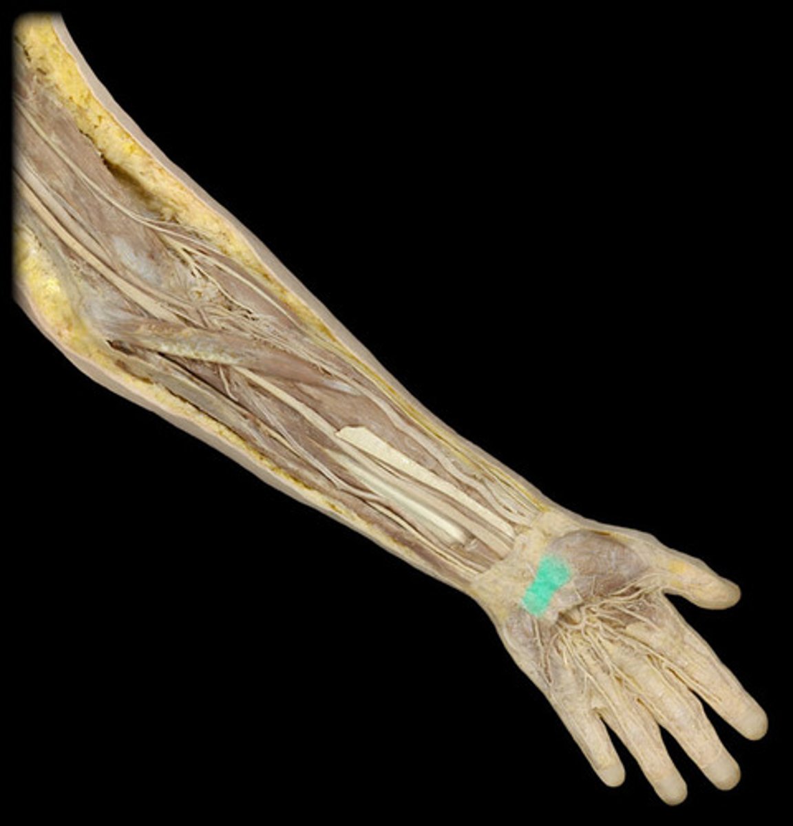 knowt flashcard image