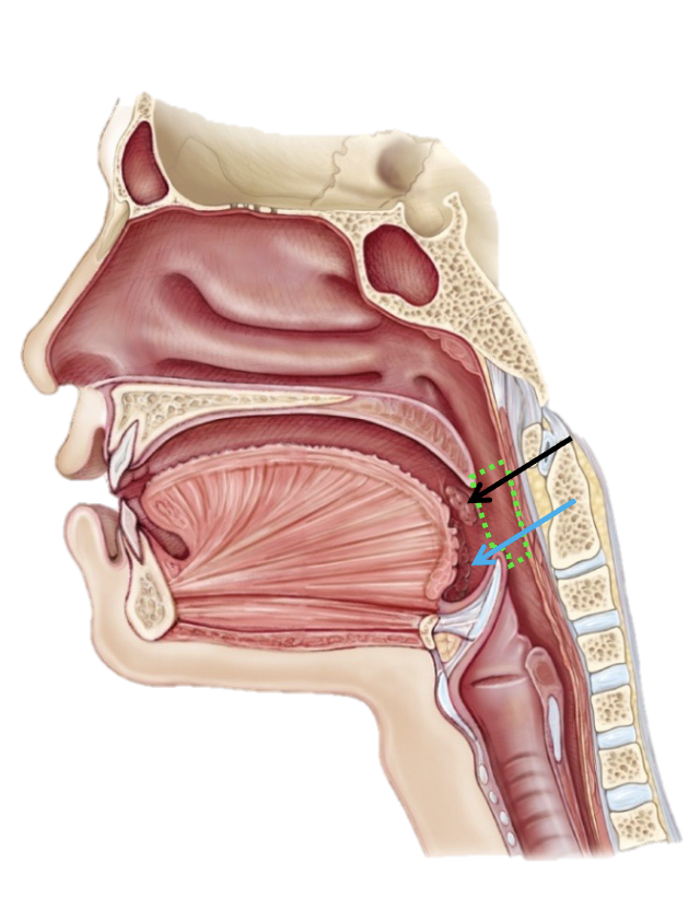 <p>Palatine Tonsil</p>