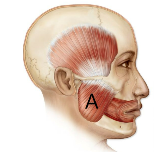 <p>what muscle of mastication is this</p>