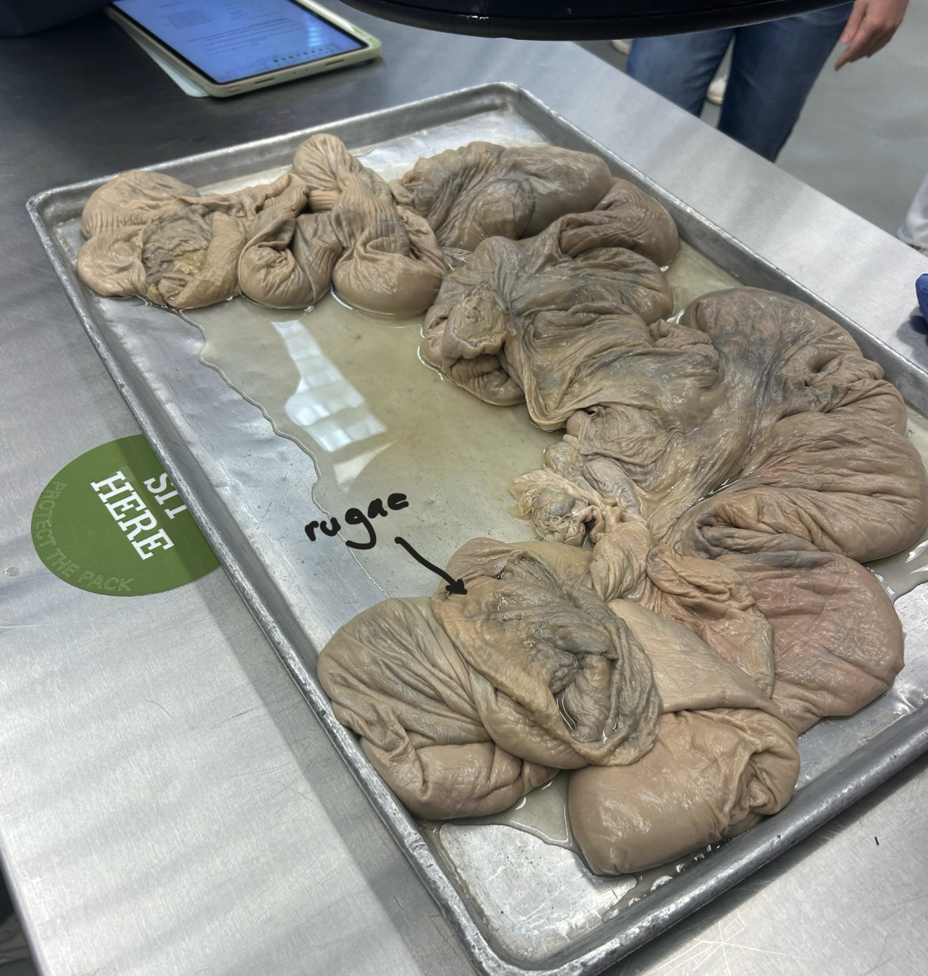 <p>Pregnant sow (diffuse placenta type) - uterus</p><p>Rugae: maternal side of placenta in pigs - think moms like reggae</p><p>-Textured</p><p>Areola: fetal side of placenta in pigs</p>
