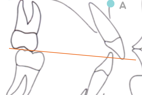 <p>Plano oclusal</p>