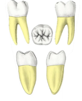 <p>Which tooth?</p>
