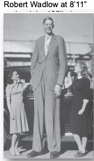 <p>Gigantism</p>