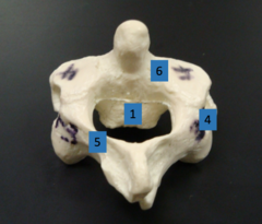 <p>what is 1</p>