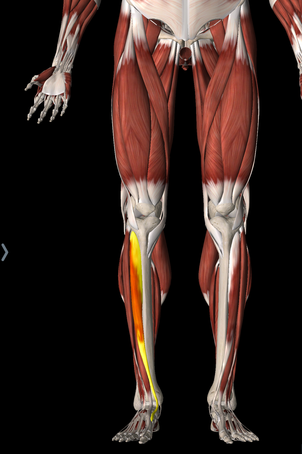 <p>What muscle is this?</p>