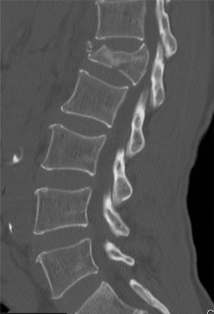 <p>What is the diagnosis?</p>