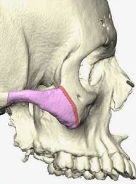 <p>Identify this bony marking</p>
