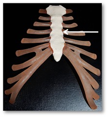 <p>disarticulated</p>