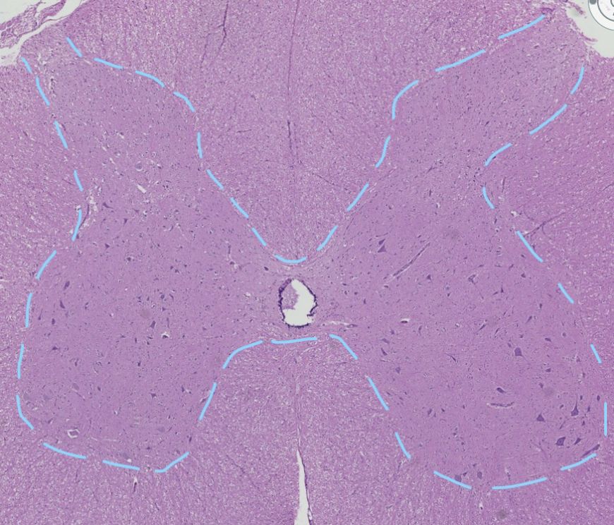 <p>Is the outlines “butterfly shaped” region in this spinal cord grey or white matter?</p>