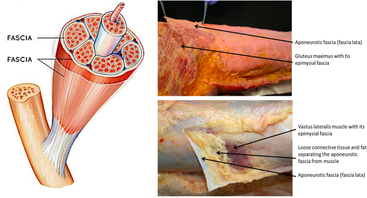 <p>Thin casing of connective tissue beneath the skin that surrounds and holds every organ, blood vessel, bone, nerve fiber, and muscle in place</p><p>The deep spaces of the head and neck are fascia-lined spaces containing loose areolar connective tissue. These are “potential” spaces, only existing when invaded by bacteria.</p>