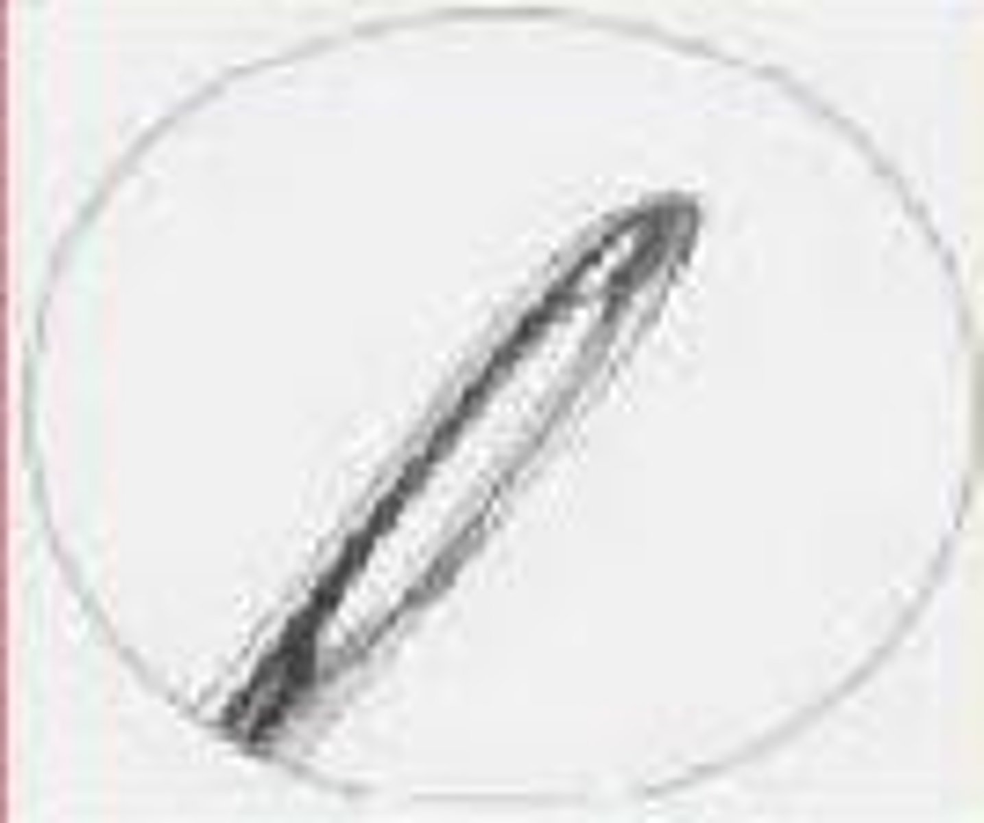 <p>the eye is the portion of he needle where the suture strand is attached. closed eye needles may have round or square holes and are loaded by inserting the end of the suture material through the hole. loading the eyed needle with the suture strand can be cumbersome process when wearing gloves or if the needle is small. the eyed needle causes more tissue damage than the eyeless needle because the suture strand is not continuous with the needle.</p>