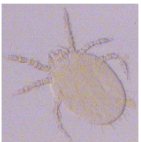 <p><strong>aoutat </strong>- acarien</p><p></p><p> petit, poilu, pattes longues</p><p></p><p>TTT : creme anti inflammatoire / histaminique</p>