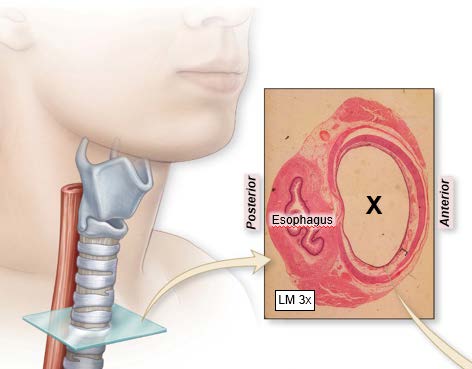 <p>Which of the following types of tissue lines the space indicated by the "X" in the image?</p>