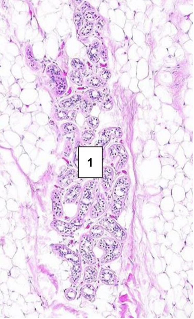 <p>What type of gland is represented in the picture?</p>