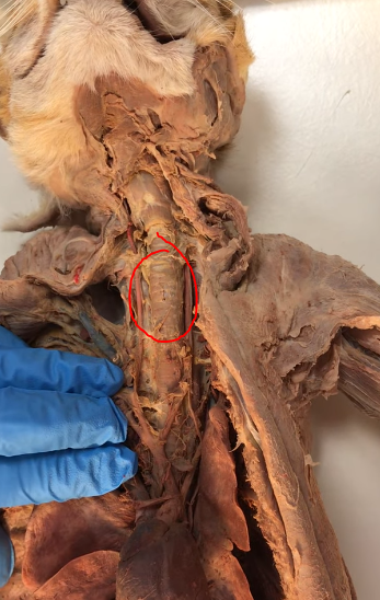 <p>What are the white rings on the trachea </p>