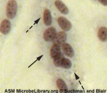 <p>syncytium and faint basophilic cytoplasmic inclusion bodies</p>