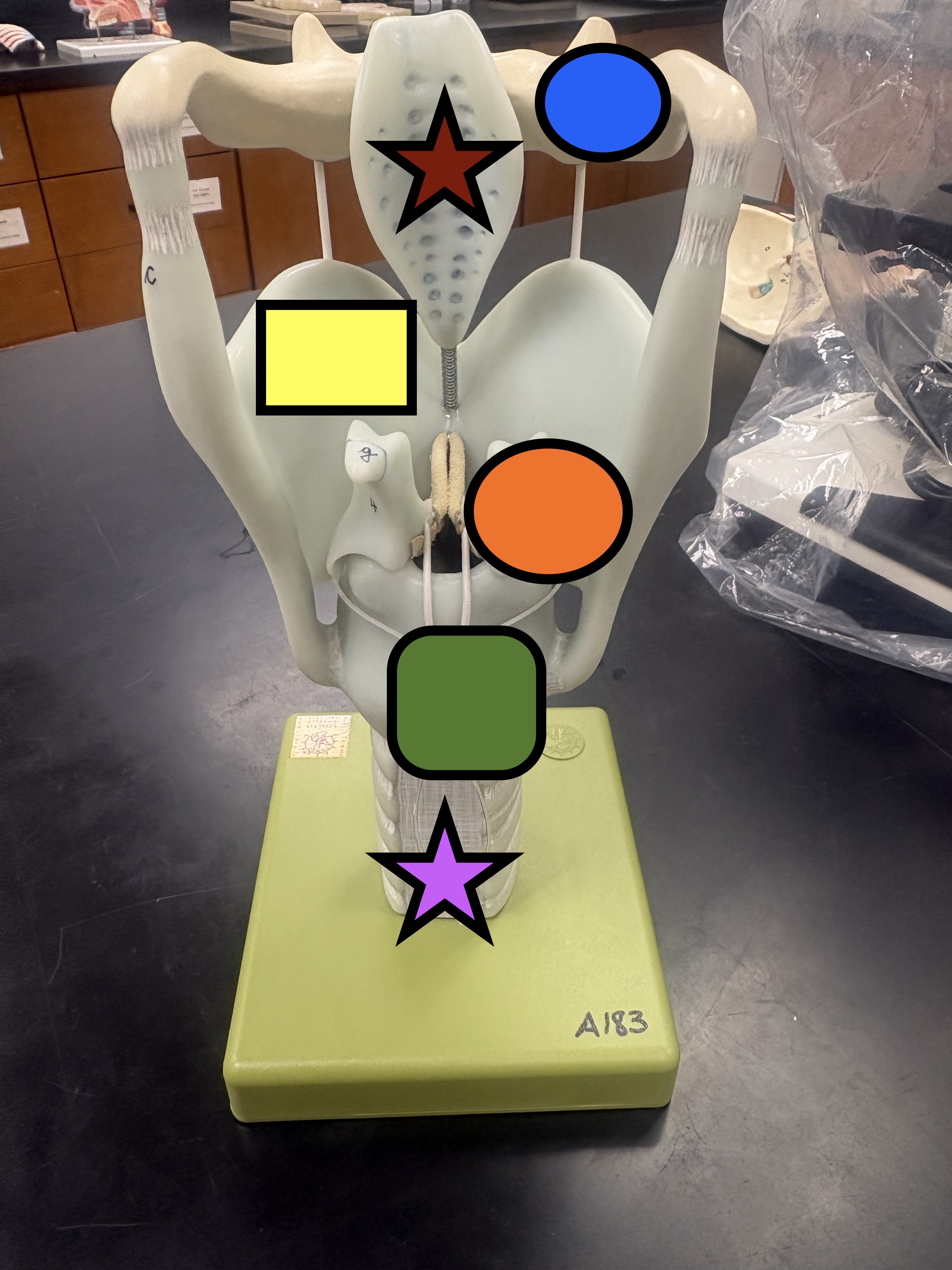 <p>What is the red star representing?</p>