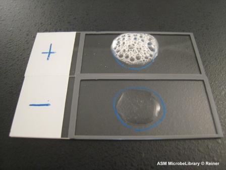 <p><mark>a foundational microbiology technique used to identify whether a bacteria produces the </mark><strong><mark>catalase enzyme</mark></strong>. It is primarily used to differentiate between <em>Staphylococcus</em> (catalase-positive) and <em>Streptococcus</em> (catalase-negative). [1, 2, 3, 4]</p>