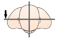 <p>Divides the body into equal anterior and posterior parts</p>