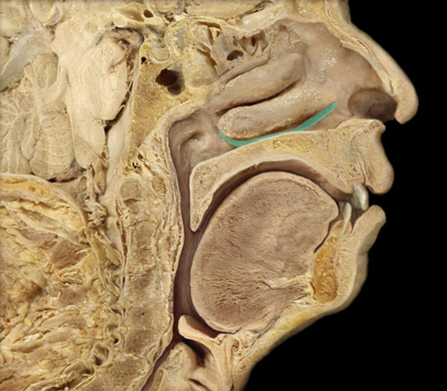 <p>Identify the feature of the nasal cavity</p>
