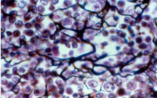 <ul><li><p><span style="background-color: transparent; font-family: "Playfair Display", serif;">Support defense cells</span></p></li><li><p><span style="background-color: transparent; font-family: "Playfair Display", serif;">Lymphoid organs (lymph nodes, bone marrow, spleen)</span></p></li><li><p><span style="background-color: transparent; font-family: "Playfair Display", serif;">Looks like blueberry bush</span></p></li></ul><p></p>