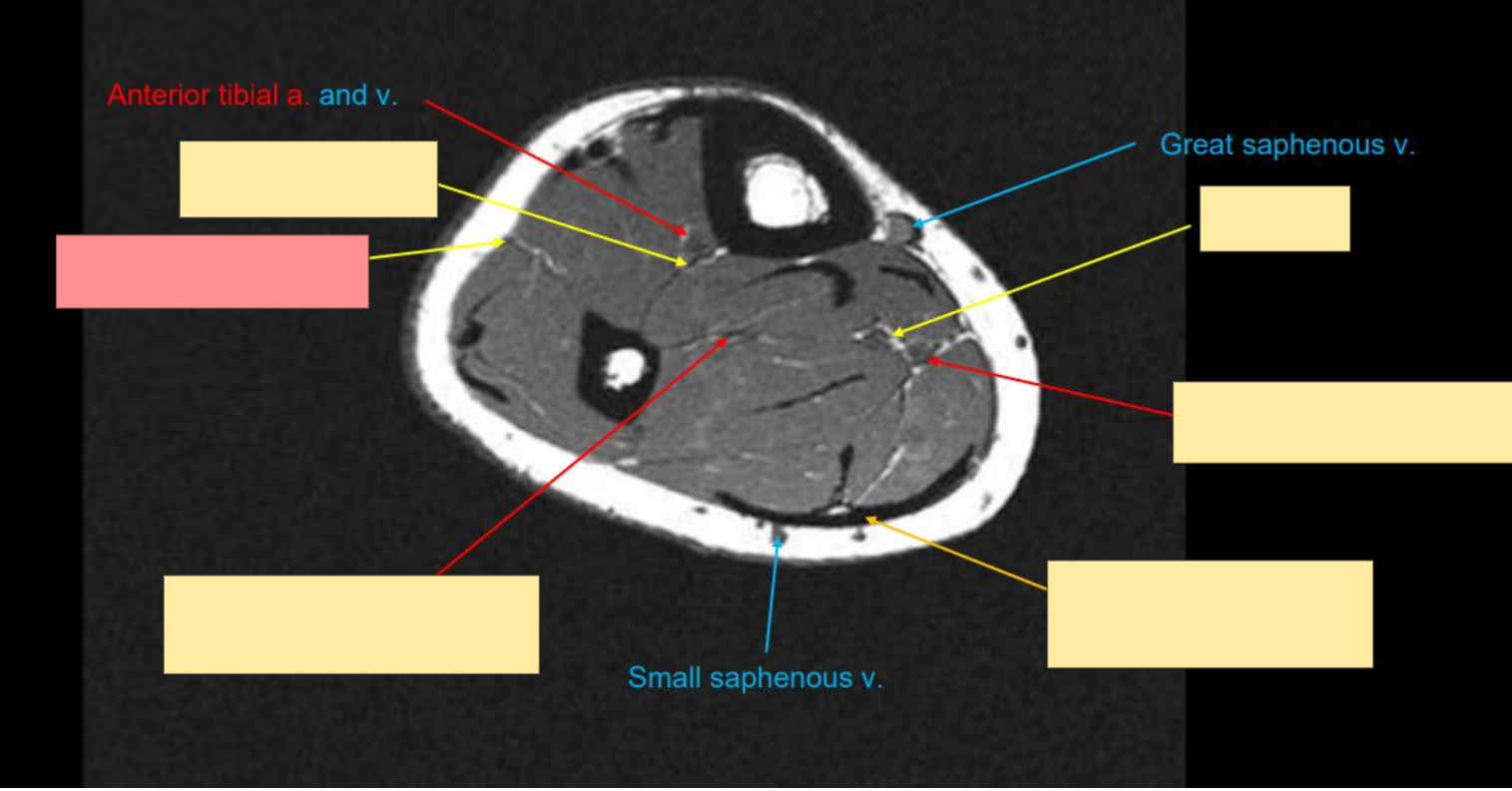 <p>Identify the structure</p>