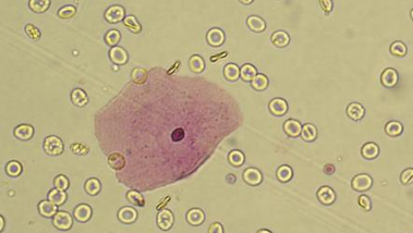 <p>Erythrocytes </p>
