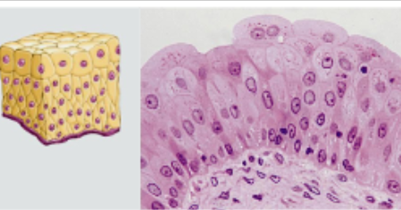 <p>what is Transitional epithelium? Function- How?</p>
