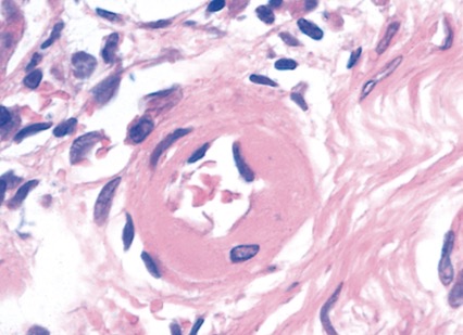 term image