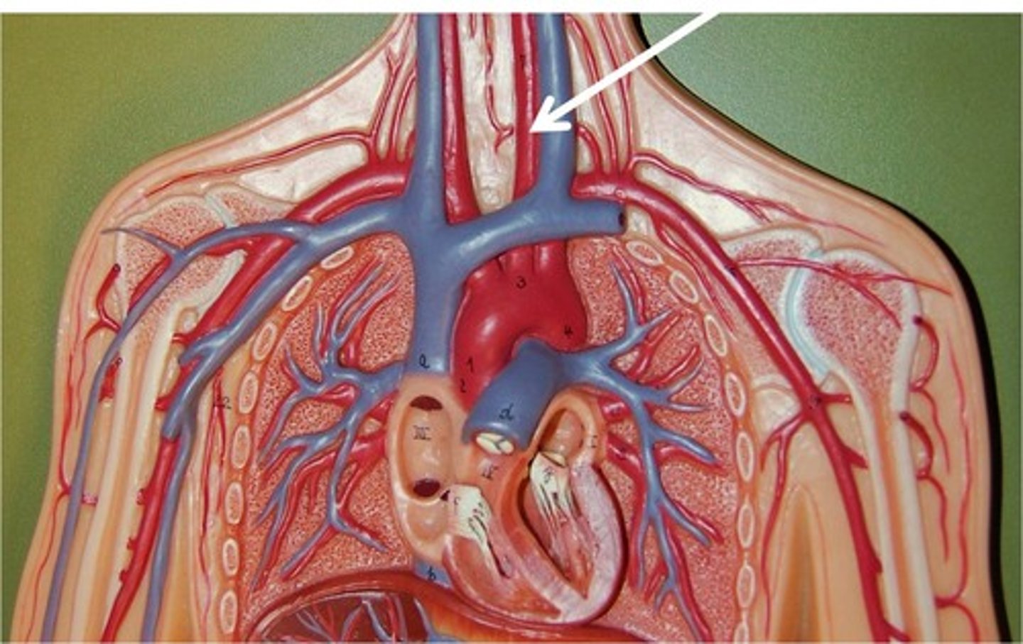 <p>The major artery that supplies blood to the head and brain.</p>