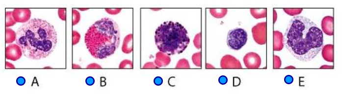 <p>Which one of these is a basophil?</p>