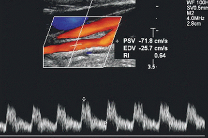 <p>Identify the vessel</p>